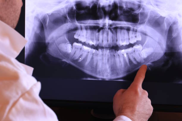 Best Knocked-Out Tooth Emergency  in Hayward, WI