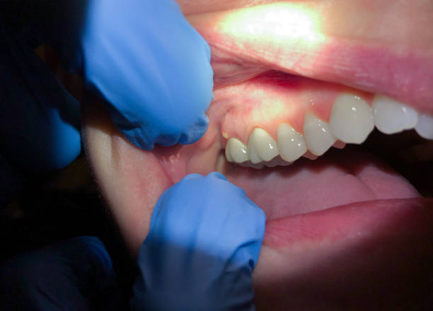 Tooth Infection Emergency Dentist in WI